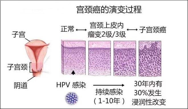 癌症检测