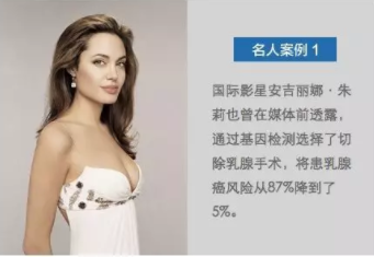 乳腺癌是怎么引起的?